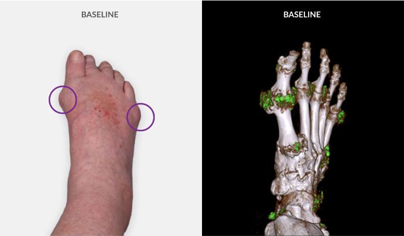 gout-tabs-slider-one
