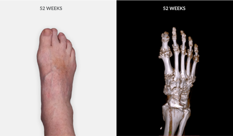 gout-tabs-slider-two